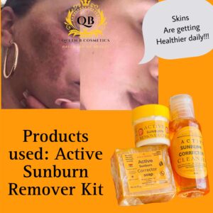 Active Sunburn Removal Kit