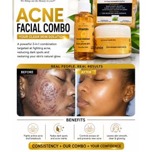 Acne Combo 2 - Hormonal Acne / Sensitive Skin