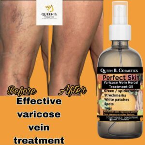 Perfect Skin Herbal Treatment Oil - Big